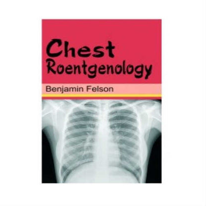 Chest Roentgenology by Benjamin Felson