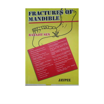 Fractures of Mandible By Ranjit Sen