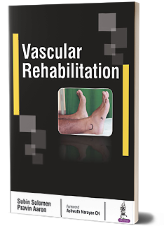 Vascular Rehabilitation by Subin Solomen