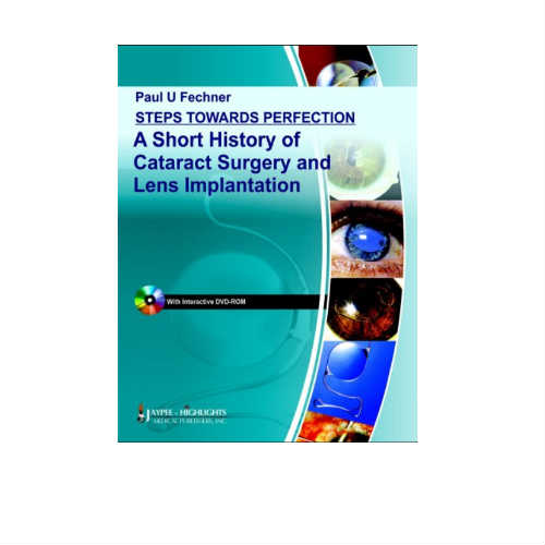 Steps Towards Perfection A Short History Of Cataract Surgery And Lens Implantation By Fechner (DISCOUNTED PRICE)