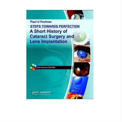 Steps Towards Perfection A Short History Of Cataract Surgery And Lens Implantation By Fechner (DISCOUNTED PRICE)