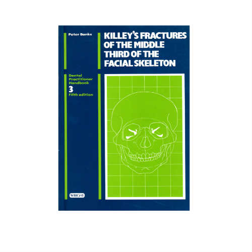 Killey's Fractures Of The Middle Third Of The Facial Skeleton