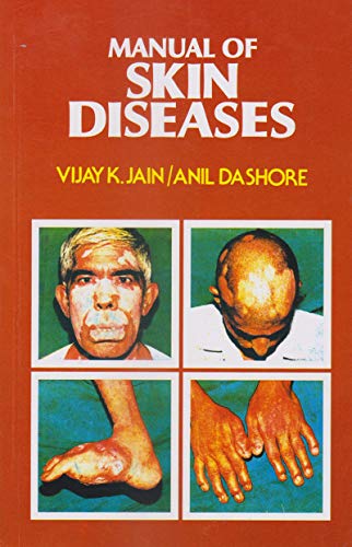 MANUAL OF SKIN DISEASES  2022 By Vijay K Jain