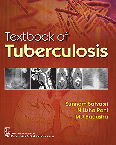 Textbook of Tuberculosis (PB 2023) By Sunnam Satyasri