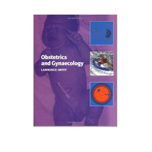 Obstetrics And Gynaecology By Lawrence Impey